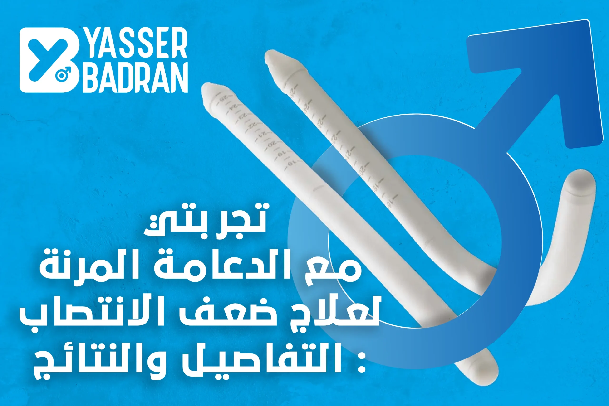 تجربتي مع الدعامة المرنة لعلاج ضعف الانتصاب: التفاصيل والنتائج